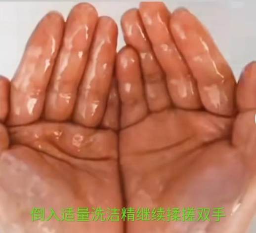 胶水粘到手怎么办